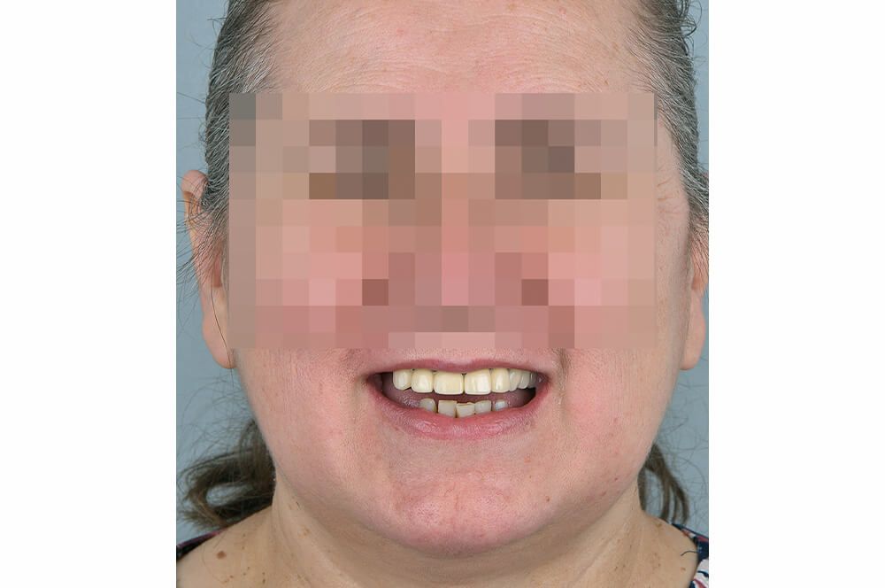 Abb 18 Erscheinungsbild der Patientin vor …