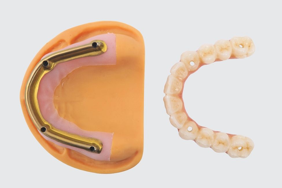 Permadental